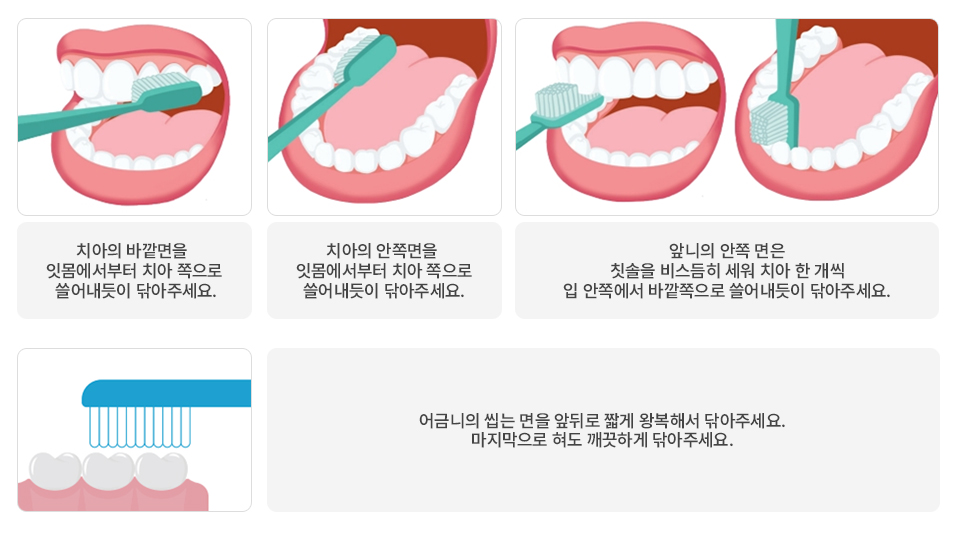 치아의 바깥면을 잇몸에서부터 치아 쪽으로 쓸어내듯이 닦아주세요. / 치아의 안쪽면을 잇몸에서부터 치아 쪽으로 쓸어내듯이 닦아주세요. /  앞니의 안쪽 면은 
    칫솔을 비스듬히 세워 치아 한 개씩 입 안쪽에서 바깥쪽으로 쓸어내듯이 닦아주세요. / 어금니의 씹는 면을 앞뒤로 짧게 왕복해서 닦아주세요. 마지막으로 혀도 깨끗하게 닦아주세요.